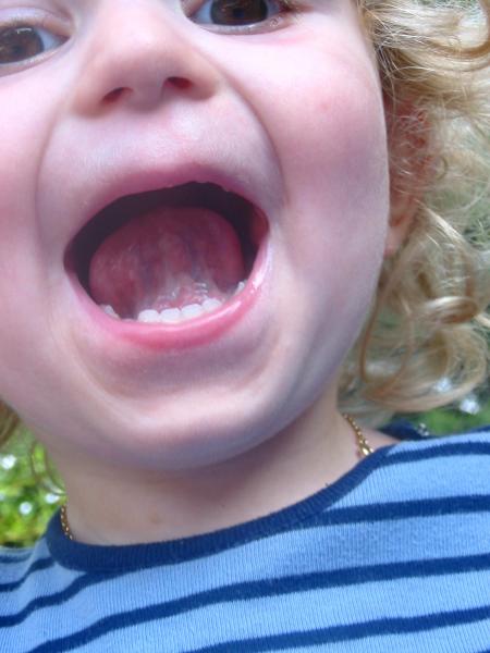 aujourd'hui j'ai 2 ans mais pas toutes mes dents!